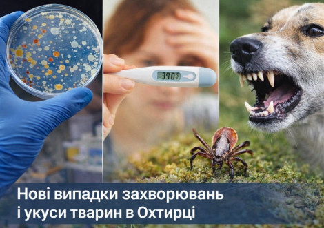 У Охтирці зафіксували нові випадки захворювань та укуси тварин